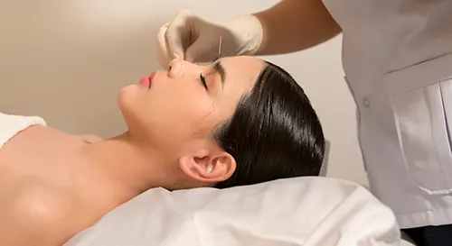 Ishitani Health Center - Can Acupuncture Help Prevent Migraines?