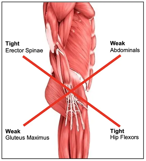 Ishitani Health Center - Lower Cross Syndrome Pain Relief in Fort Lee, NJ Ishitani Health Center - Lower Cross Syndrome Pain Relief in Fort Lee, NJ